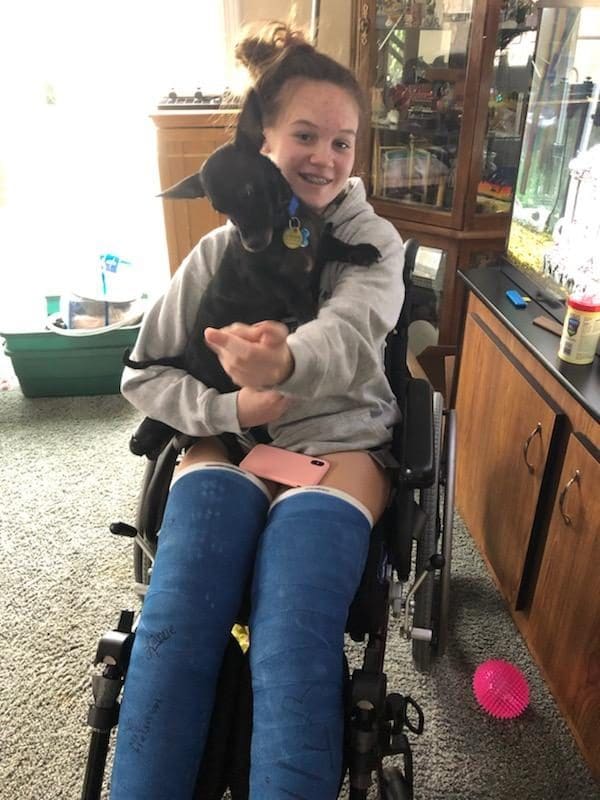 Girl in wheelchair smiling and pointing holding small dog and wearing two above-knee casts.